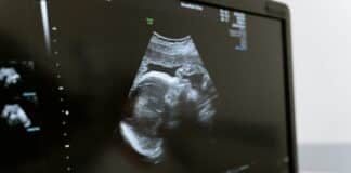 abortion