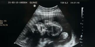 unborn